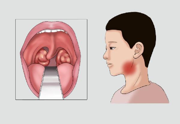 女人穿提臀裤有作用吗